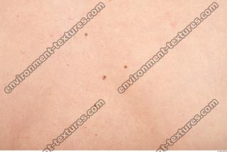 photo texture of white skin 0046